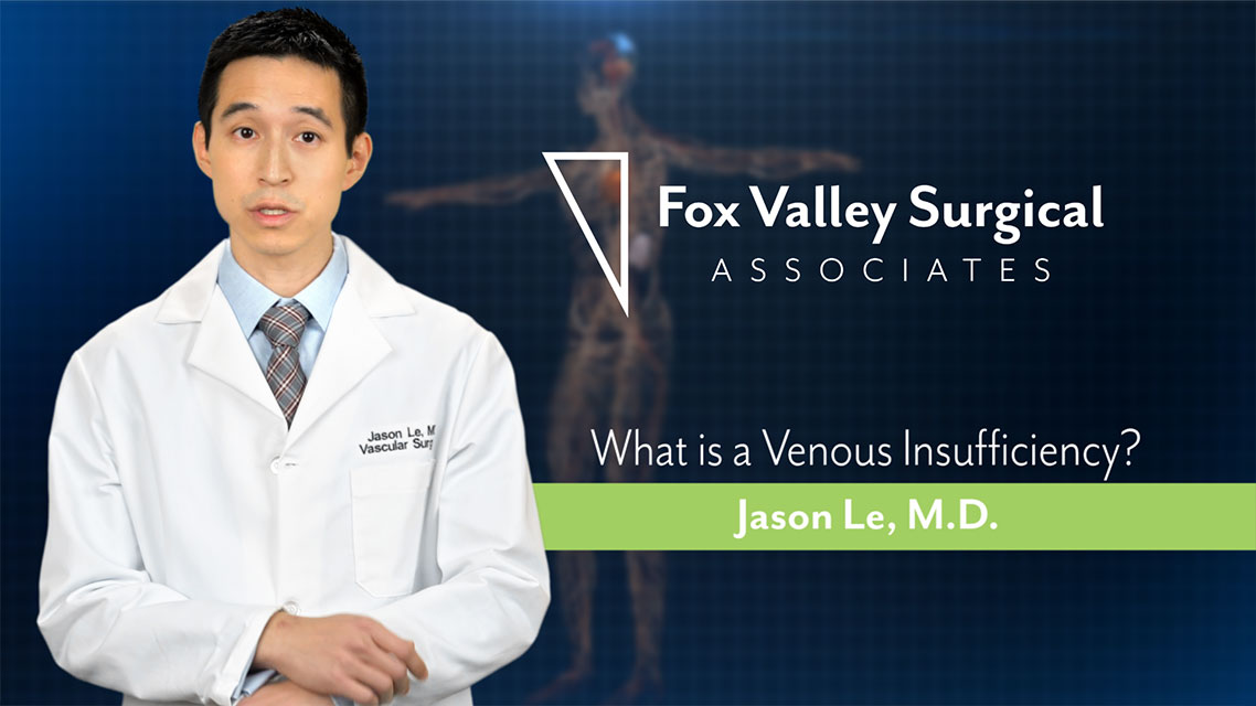 Venous Insufficiency - Fox Valley Surgical Associates